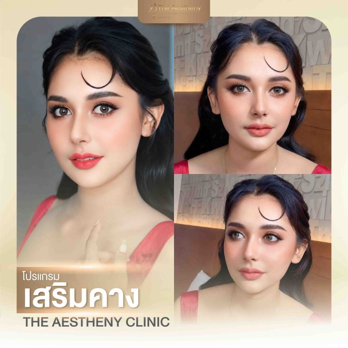 07to10-The Aestheny-M1-02