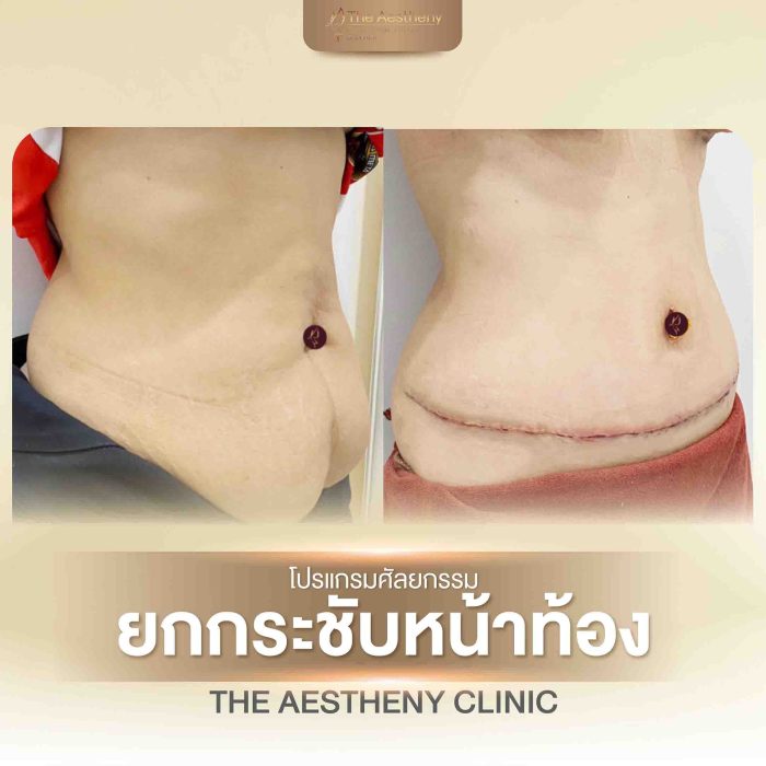 29-The Aestheny-M1-01