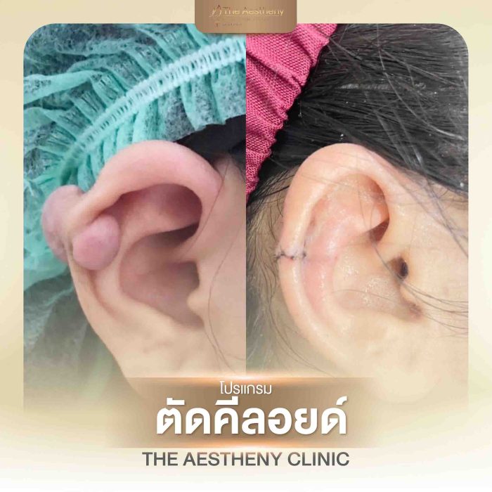 32-The Aestheny-M1-01